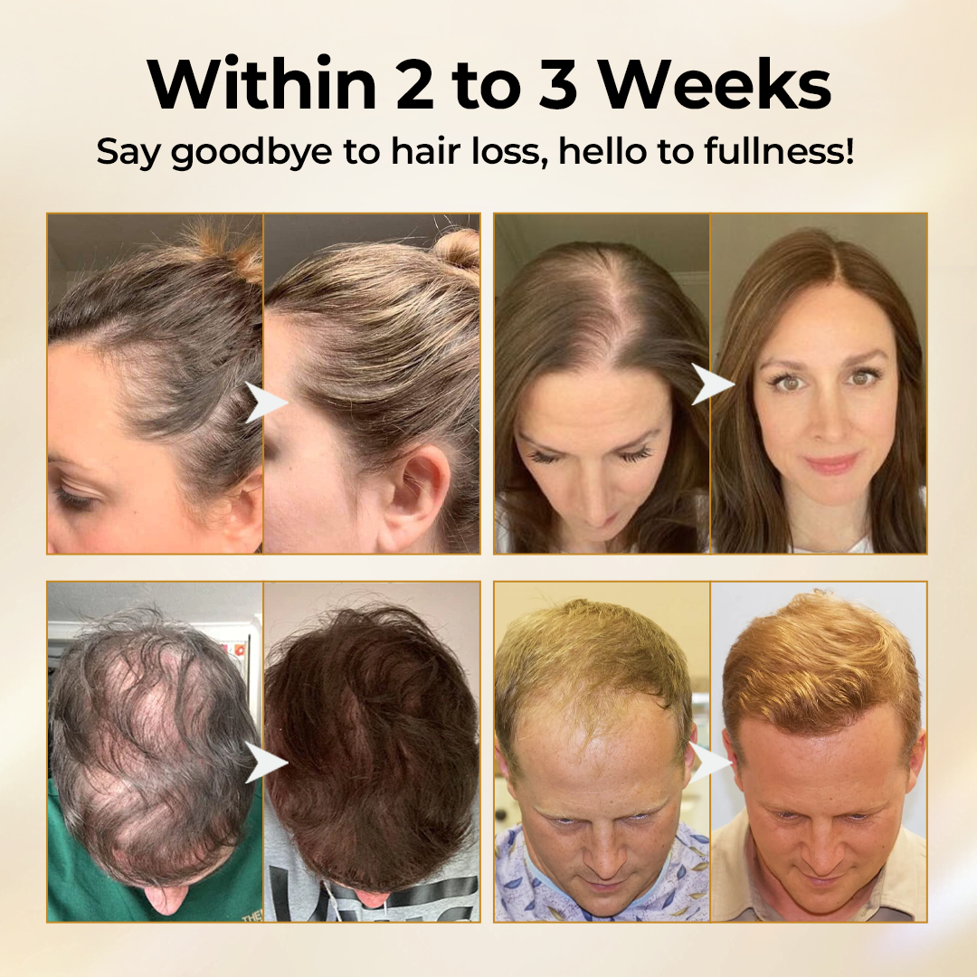 Acezozla® CollagenGrow Peptides Hair Growth Spray