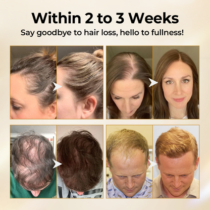 Acezozla® CollagenGrow Peptides Hair Growth Spray