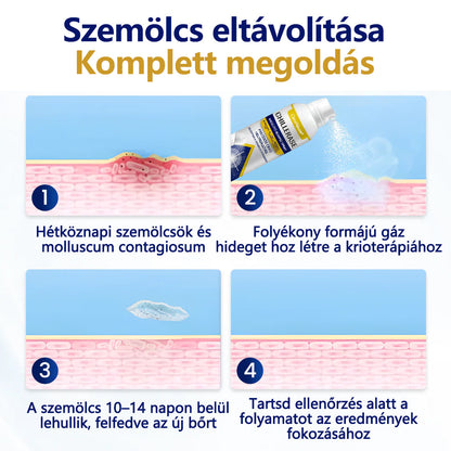 🔥Készlet fogy, mielőtt elfogy! CleraNaure® ChillErase dudorjavító spray