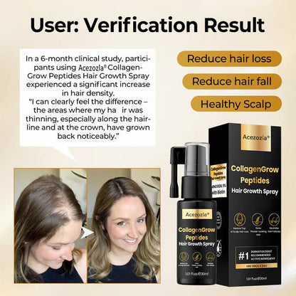 Acezozla® CollagenGrow Peptides Hair Growth Spray