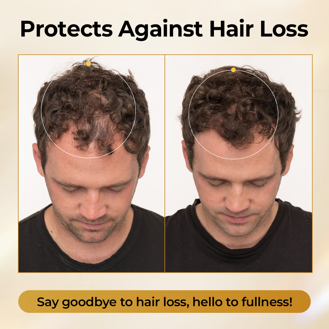 Acezozla® CollagenGrow Peptides Hair Growth Spray