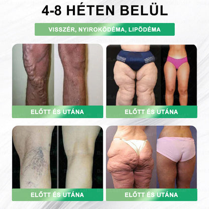 BuildLeafe® GLP-1 8-in-1 Fit & Vital Szájhigiéniai oldat Alkalmas elhízás, szív- és érrendszeri egészség, cukorbetegség, alvási apnoe, bélrendszeri egészség, ízületiproblémák és egyéb egészségügyi igények esetén