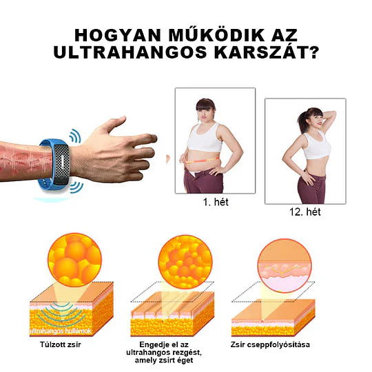 🥑 𝐉𝐎𝐒𝐅𝑰𝐓™ Ultrahangos csuklópántok a zsír eltávolítására és méregtelenítésére