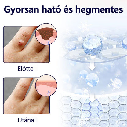 Laleia®✅✅✅ WartErase – Fagyasztó Szemölcseltávolító Spray