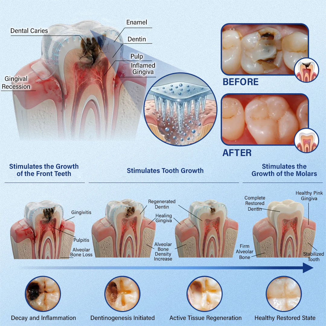 A Te Mosolyod🦷Ceoerty® Fog‑ és Ínyjavító Gyorsan Oldódó Mikrotűs Tapasz✨ (𝟓‑az‑1‑ben 💎 Zománc és Dentin Újraépítése • Ínyek Erősítése • Fogkő és Rossz Szag Megszüntetése • Fogfehérítés • Fogérzékenység Megállítása)