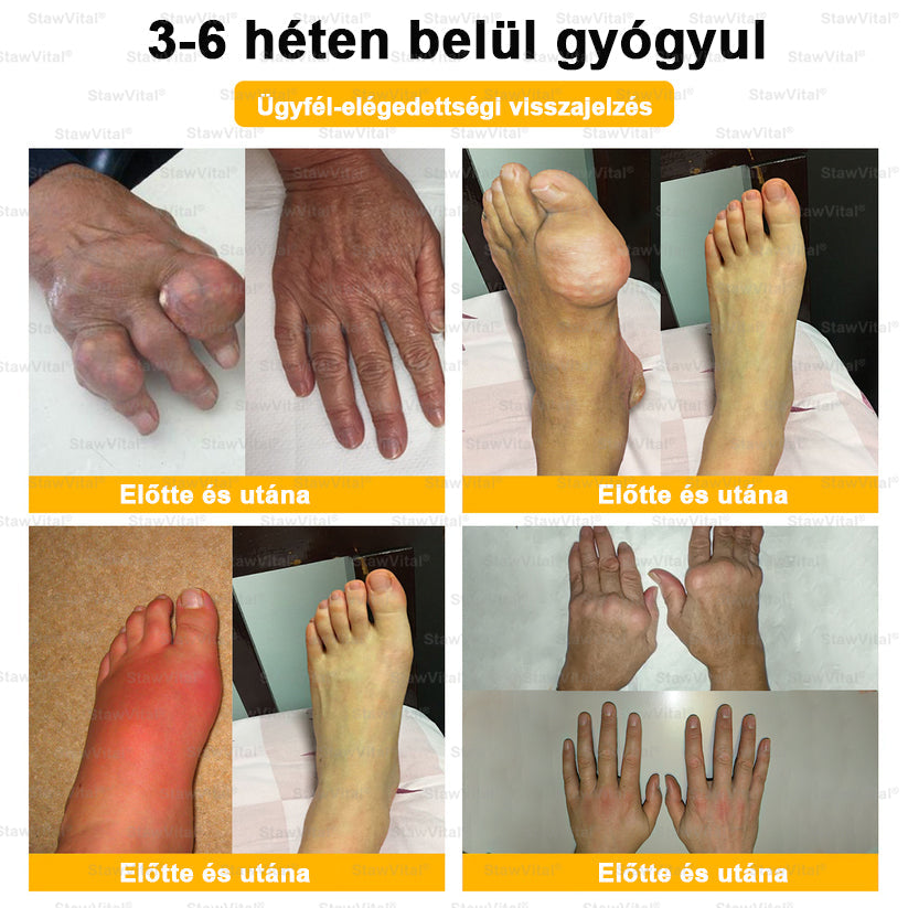 StawVital® Botoxot ésMéhmérget TartalmazóRegenerÃ¡ló KrÃém iz¼letekre ésCsontokra lMOT(MagyarOrtopéd Társaság) általtanúsitott termék