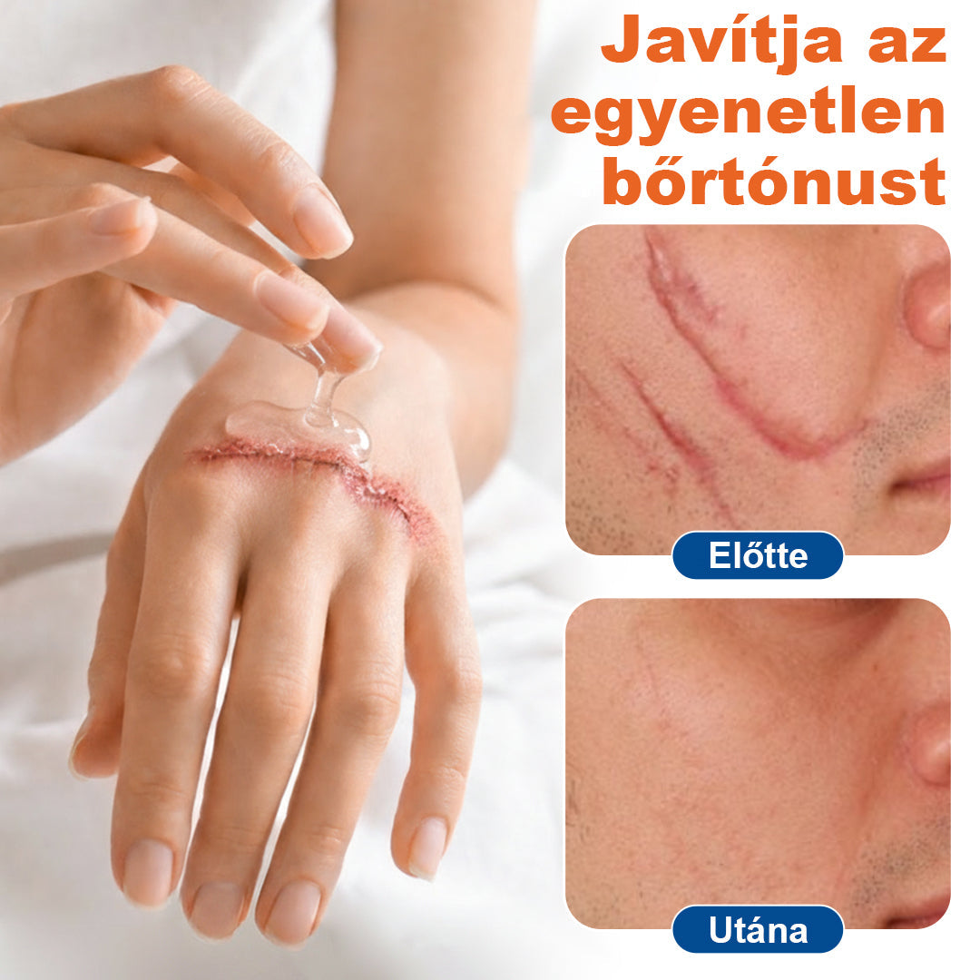 🔥Laleia® DermalRebuild bőrfiatalító gél