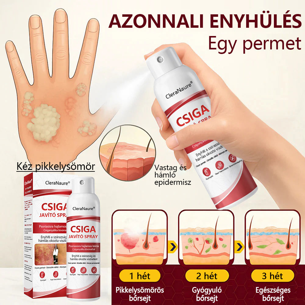 CleraNature® Bálnazsír Spray Viszkető, Hámló Psoriasisra Hajlamos Bőrre⭐