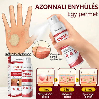 CleraNature® Bálnazsír Spray Viszkető, Hámló Psoriasisra Hajlamos Bőrre⭐