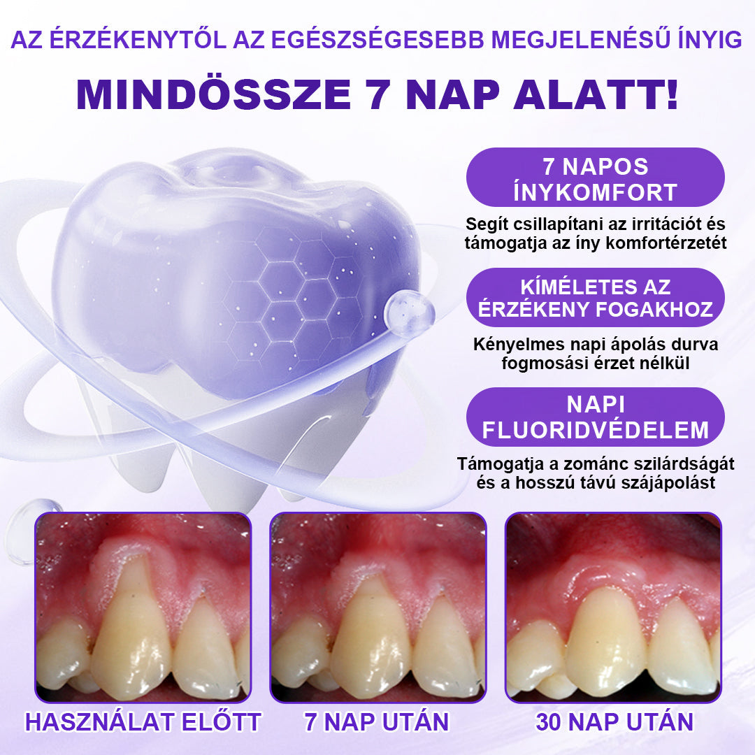 ⭐⭐Laleia® SensiGum Fluoridos Fogkrém