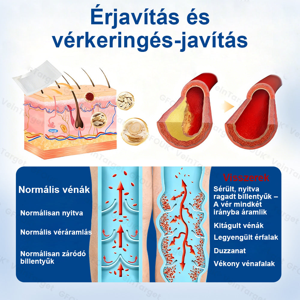 ✅✅✅Laleia® Vein Ease mikrotűs tapasz