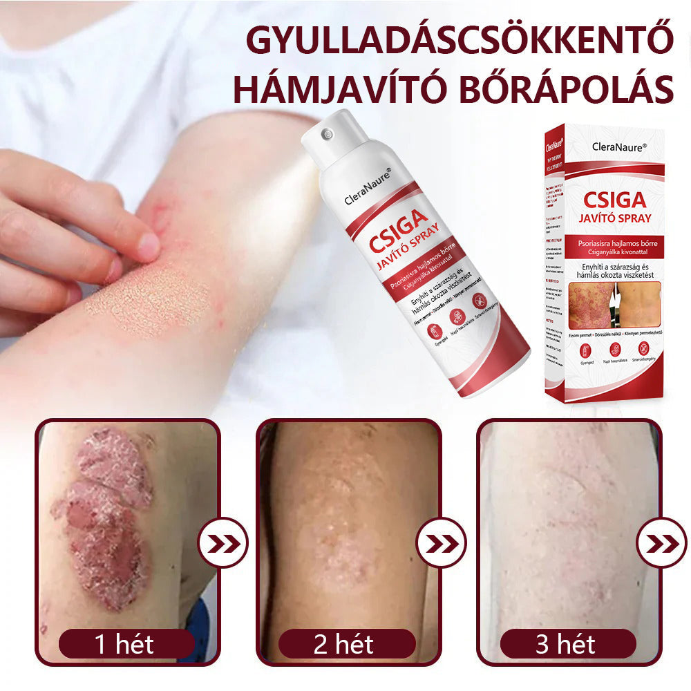 CleraNature® Bálnazsír Spray Viszkető, Hámló Psoriasisra Hajlamos Bőrre⭐