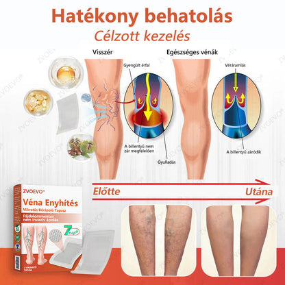 ☘️ Zvoevo® Vein Ease mikro-tűs ápoló tapasz (pókgerincvénák, visszér, duzzanat, fáradt lábak kezelésére)📦