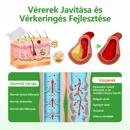 🌿Laleia® VeinHeal mikrotűs tapasz