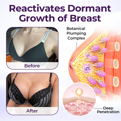 The Secret to a Perfectly Plump Bust – Acezozla® Maxcurve Lift & Plump Cream