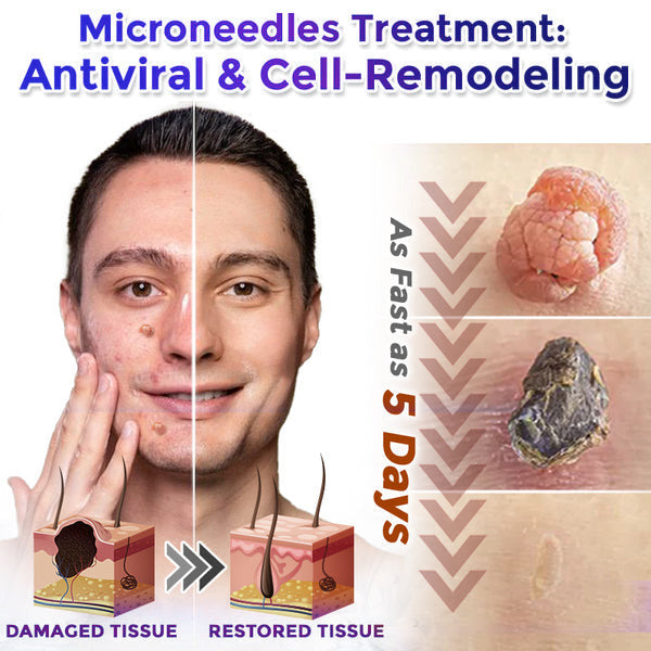 💧🍣Celsiora® Multi-Functional Microneedle Hydrocolloid Patch Roll | Targets Skin Tags, Warts & Stubborn Blemishes