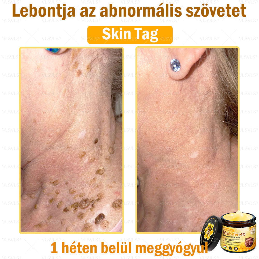 💜💜VLSVLS® Méhméreg Bőrhelyreállító Krém (👨‍⚕‍CE jóváhagyott)👍✅