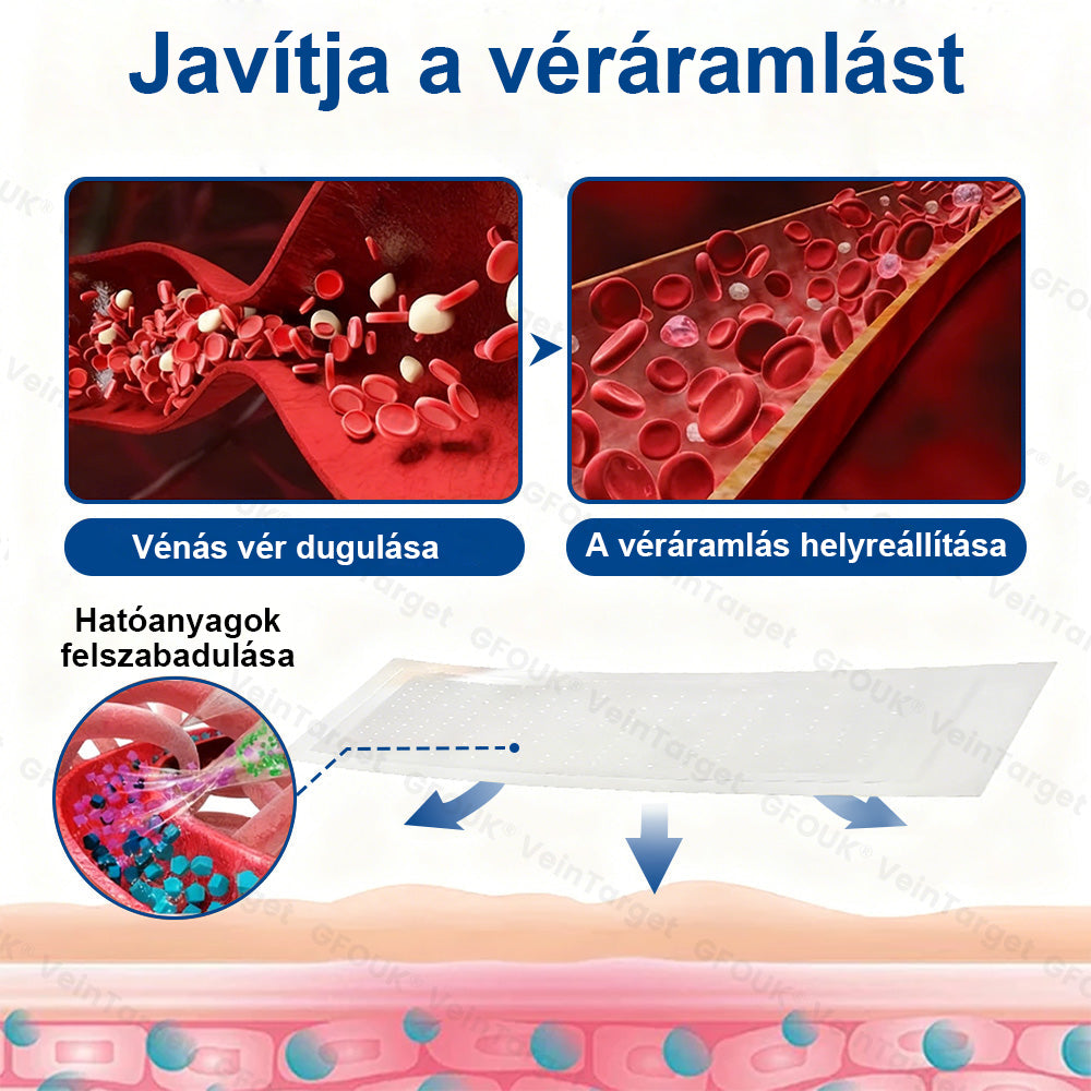✅✅✅Laleia® Vein Ease mikrotűs tapasz