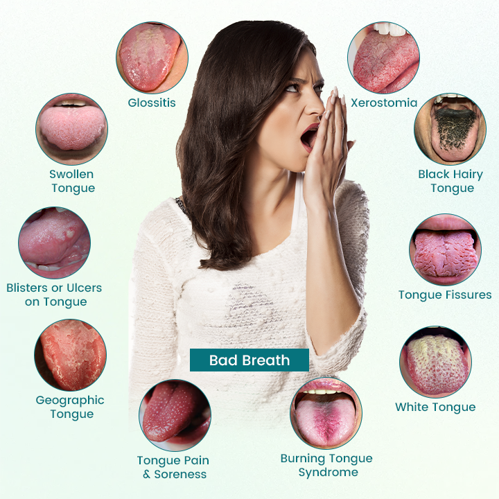 🔥GlosShield Tongue Repair Spray🔥