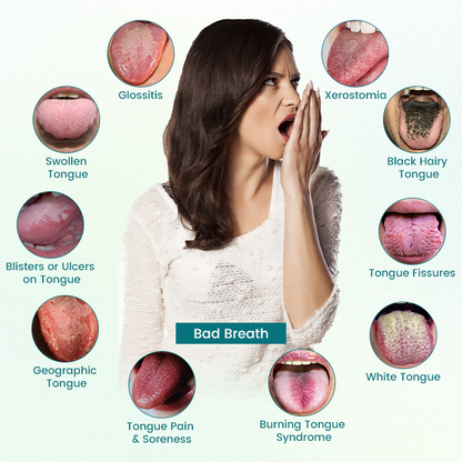 🔥GlosShield Tongue Repair Spray🔥