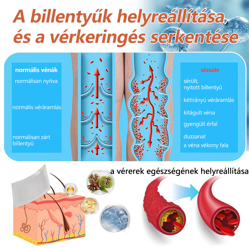 ☘️ Zvoevo® Vein Ease mikro-tűs ápoló tapasz (pókgerincvénák, visszér, duzzanat, fáradt lábak kezelésére)📦