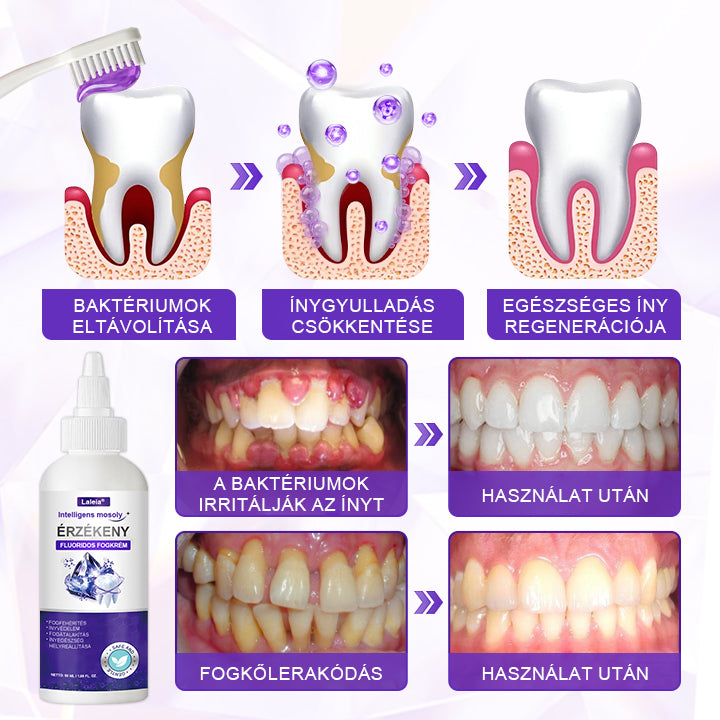 ⭐⭐Laleia® SensiGum Fluoridos Fogkrém