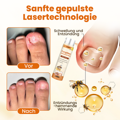 Timilk® FungiBee Fortschrittliches Nagelreparatur-Spray🔥