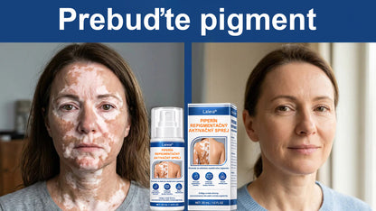 🌿🌿Laleia® Piperín Repigmentačný aktivačný sprej