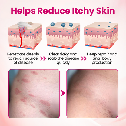 🏆 Breakthrough in Women’s Intimate Health! Feel Relief in Just 3 Days with Multi-Targeted HPV Defense