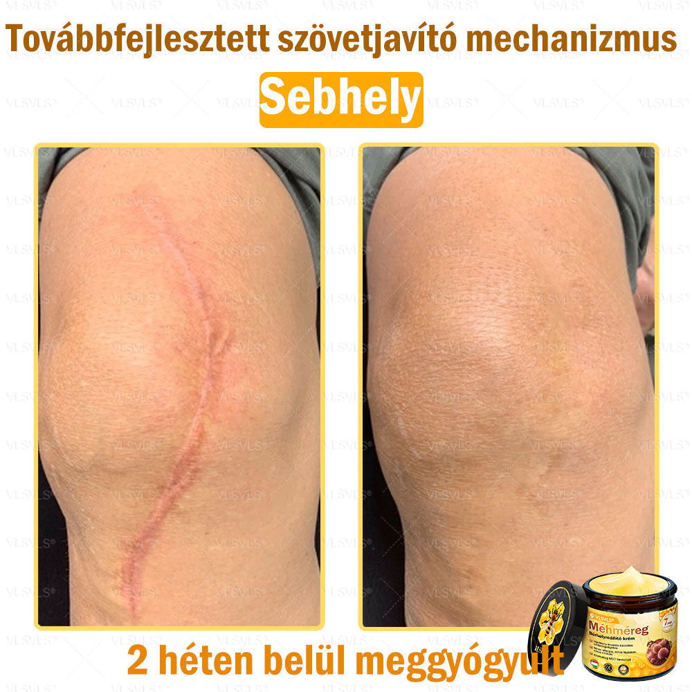 VLSVLS® Méhméreg Börhelyreállító Krém(CEjóváhagyott)