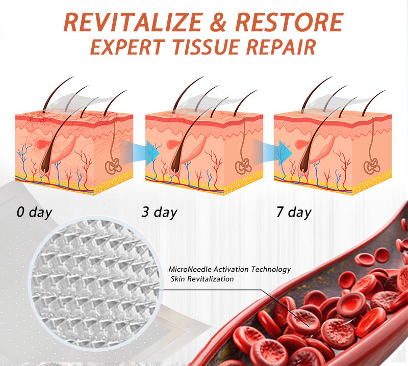 🌿❤️Celsiora® Vein Ease Microneedle Care Patch(For Spider Veins, Varicose Veins, Swelling & Leg Fatigue) - Last Day Promotion 50% OFF