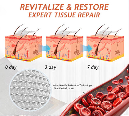 🌿❤️Celsiora® Vein Ease Microneedle Care Patch(For Spider Veins, Varicose Veins, Swelling & Leg Fatigue) - Last Day Promotion 50% OFF