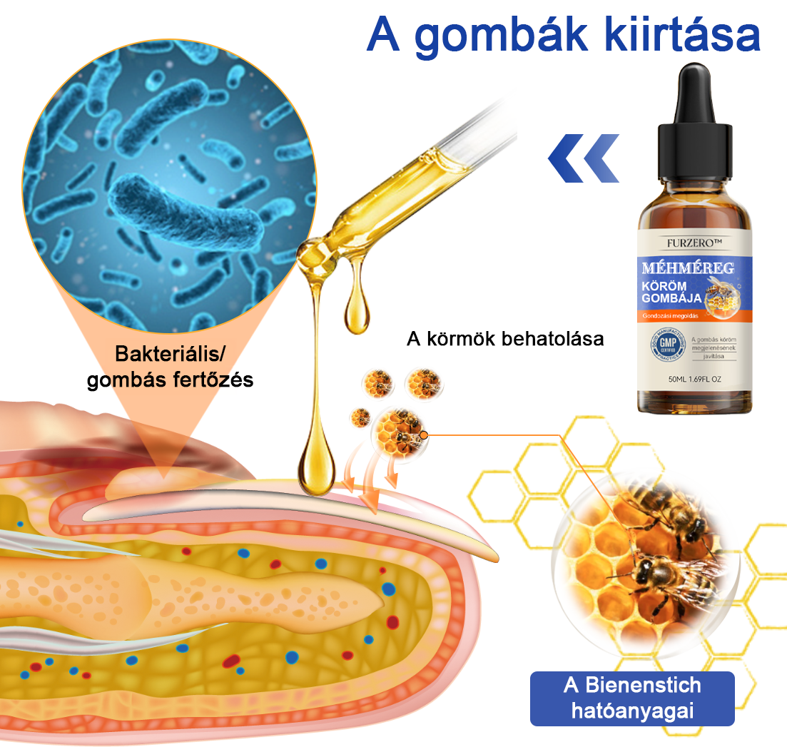 🐝Furzero™ Méhméreg Körömgomba Kezelő Oldat: Teljes megoldás a körömgomba problémájára