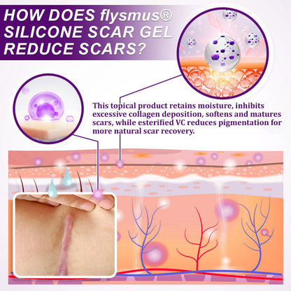 💙💙UKCA-TANÚSÍTVÁNYÚ ✅flysmus® cure ARC- ÉS TESTHEGEKRÉM GÉL – Klinikailag bizonyítottan lágyítja, simítja és halványítja a műtéti hegeket, aknés nyomokat, égési sérüléseket, keloidokat és traumás hegeket.