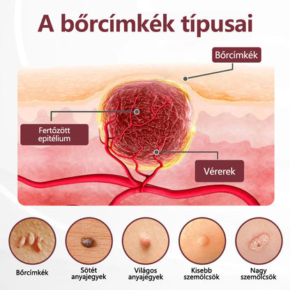 ⭐💎Hivatalos áruház👨‍⚕️ CleraNaure® KeraErase - Kettős hatású bőrfiatalító krém 👨‍⚕️ (Kettős hatású fiatalítás – simítja a kiemelkedő dudorokat és lebontja a mélyen lerakódott keratint savak és irritáció nélkül)