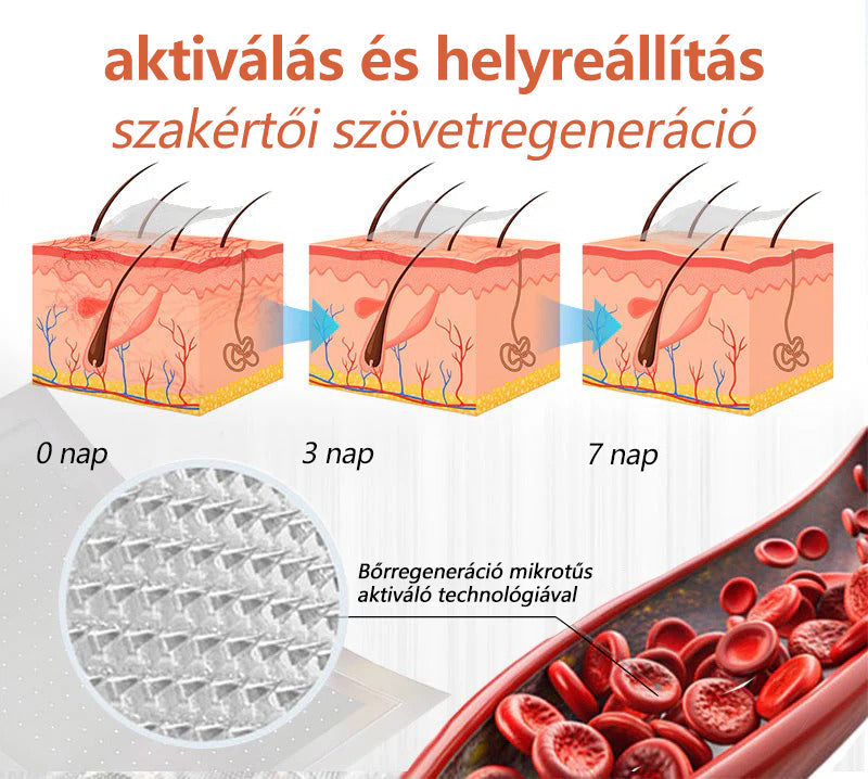 ☘️ Zvoevo® Vein Ease mikro-tűs ápoló tapasz (pókgerincvénák, visszér, duzzanat, fáradt lábak kezelésére)📦