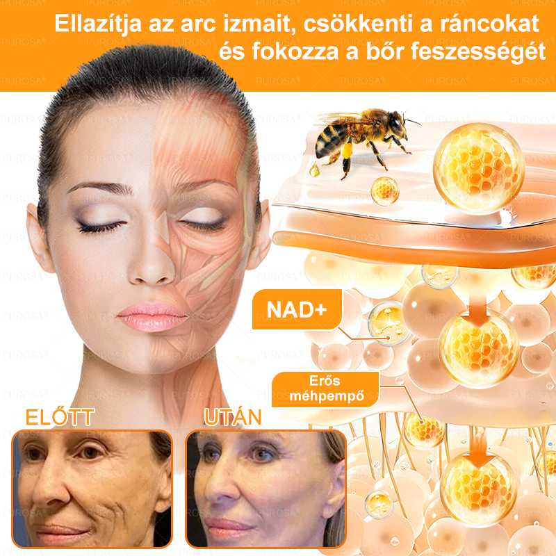 Magyarországról készült és szállított👩🏻‍⚕️✅PUROSA® Méhméreg Bőrfelújító Krém 🔥 UTOLSÓ NAP – 80% KEDVEZMÉNY🔥