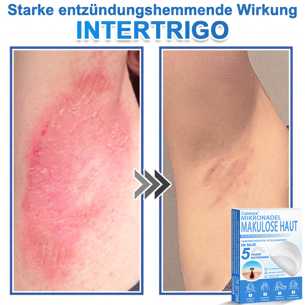 🏆Celsiora® 2-in-1 Mikronadel- & Hydrokolloid-Pflaster | Entferner für erhabene Muttermale, Akne, flache Warzen & Hautanhängsel | Verbessert Falten, Narben & Hautunreinheiten | Unsichtbare Stern-Pickelpflaster für Gesicht & Körper