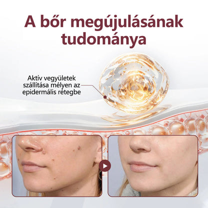 ⭐💎Hivatalos áruház👨‍⚕️ CleraNaure® KeraErase - Kettős hatású bőrfiatalító krém 👨‍⚕️ (Kettős hatású fiatalítás – simítja a kiemelkedő dudorokat és lebontja a mélyen lerakódott keratint savak és irritáció nélkül)