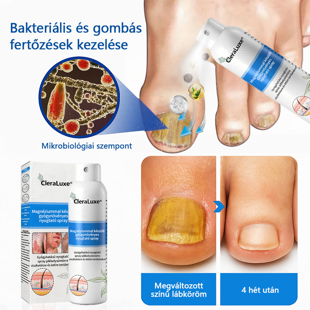 CleraLuxe®  Magnézium Gyógynövényes Pszoriázis Spray📦