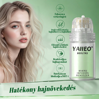 🍍𝐘𝐀𝐈𝐈𝐄𝐎® 𝑭á𝒋𝒅𝒂𝒍𝒐𝒎𝒎𝒆𝒏𝒕𝒆𝒔 𝑴𝒊𝒌𝒓𝒐𝒊𝒏𝒇ú𝒛𝒊ó𝒔 𝑹𝒆𝒏𝒅𝒔𝒛𝒆𝒓 Mélyen ható DHT-blokkolás, hajhagymák újraaktiválása és látható hajnövekedés