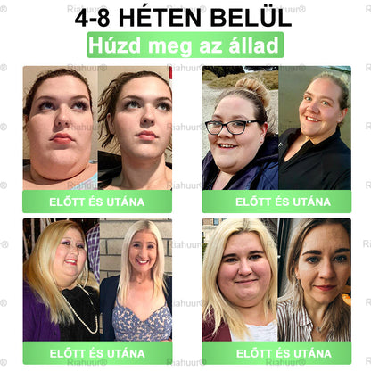 💐𝑹𝒊𝒂𝒉𝒖𝒖𝒓® Moringa × Berberin × AMPK 8-Benefit Karcsúsító & Metabolikus Nano Mikrotűs Tapasz 🇭🇺 (Naponta csak egyszer, látható változások már 7 nap alatt) ✅ Elhízás, megereszkedett bőr, cukorbetegség, alvási apnoe, ízületi problémák és még sok más esetén 💥