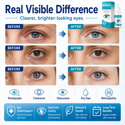 Daily Moisturizing Eye Drops | Refreshing Comfort for Dry, Tired-Feeling Eyes-YH