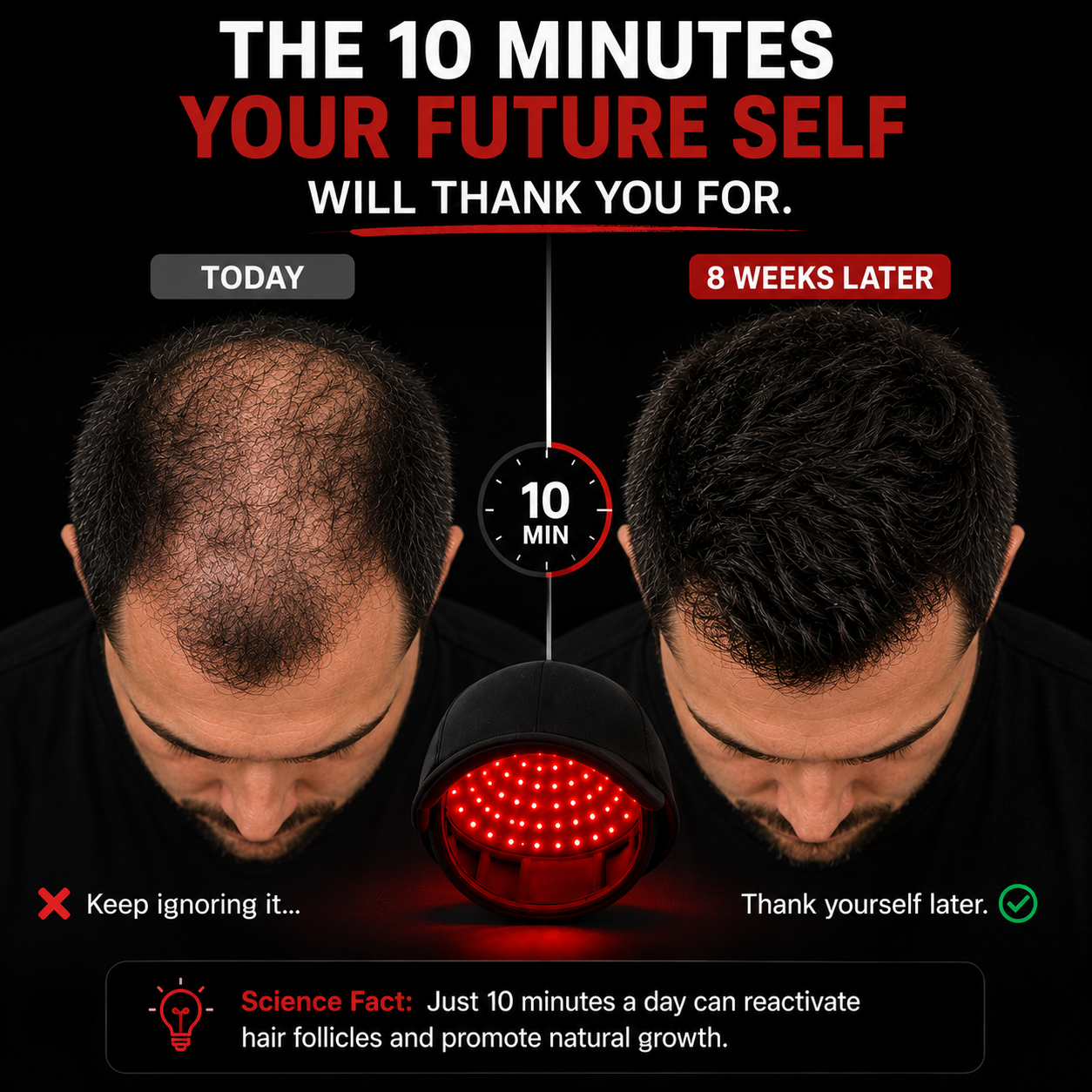 🔥 Advanced Clinical-Grade Red Light Hair Regrowth Therapy Cap