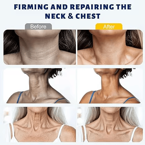 ✨ Tryurvplus™ Instant Neck Lift Cream  — 🧴 Infused with Retinol & Hyaluronic Acid | Firms the Neck, Reduces Wrinkles & Double Chin