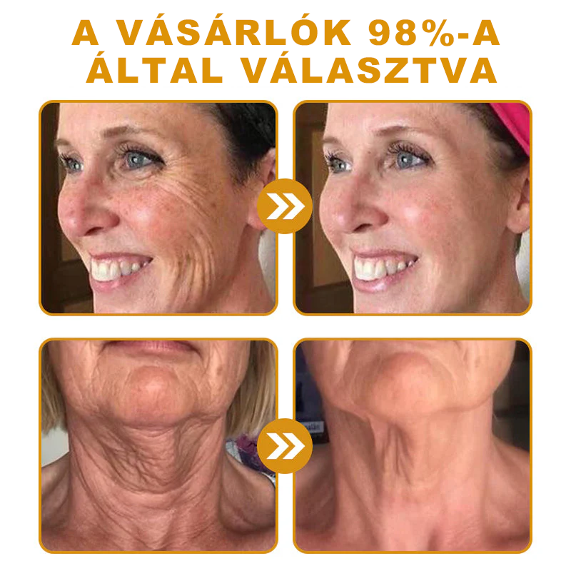 🐝PUROSA® Méhméreg Bőrregeneráló Krém | Teljes körű megoldás makacs bőrproblémákra, például öregedés, ekcéma, hegek és pikkelysömör ellen 🌿✨