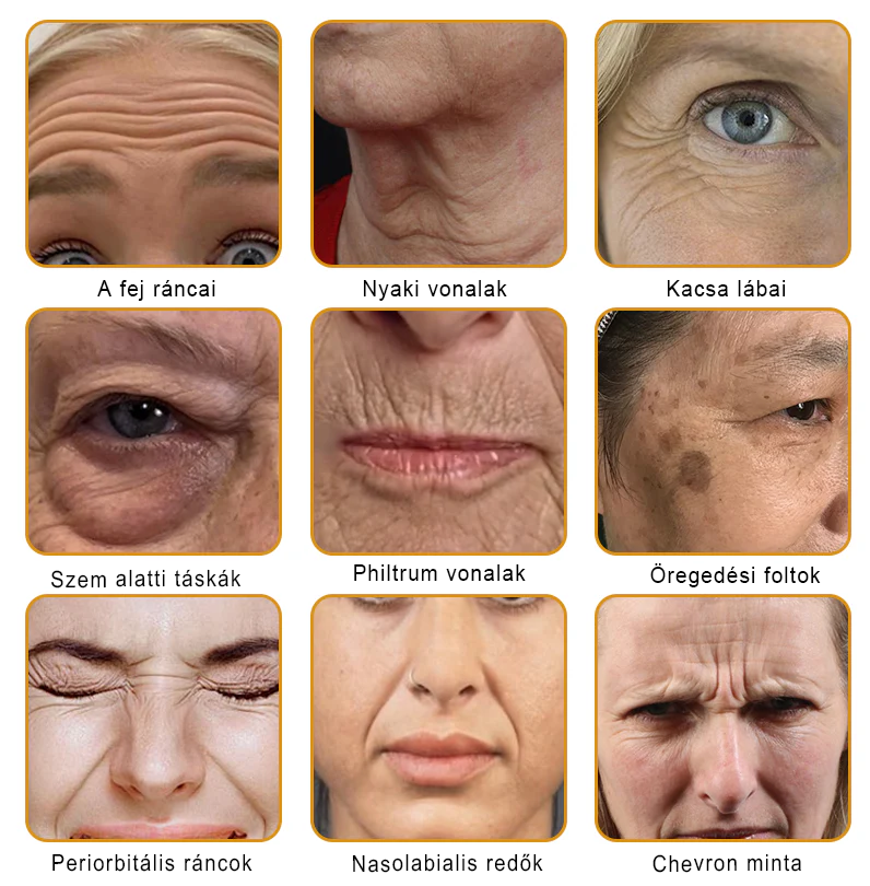 🐝PUROSA® Méhméreg Bőrregeneráló Krém | Teljes körű megoldás makacs bőrproblémákra, például öregedés, ekcéma, hegek és pikkelysömör ellen 🌿✨