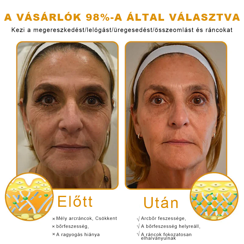 🐝PUROSA® Méhméreg Bőrregeneráló Krém | Teljes körű megoldás makacs bőrproblémákra, például öregedés, ekcéma, hegek és pikkelysömör ellen 🌿✨