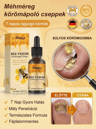 ✨[7 Napos Csodás Körömfényesítés]🐝 Méhméreg Prémium Körömápoló Cseppek