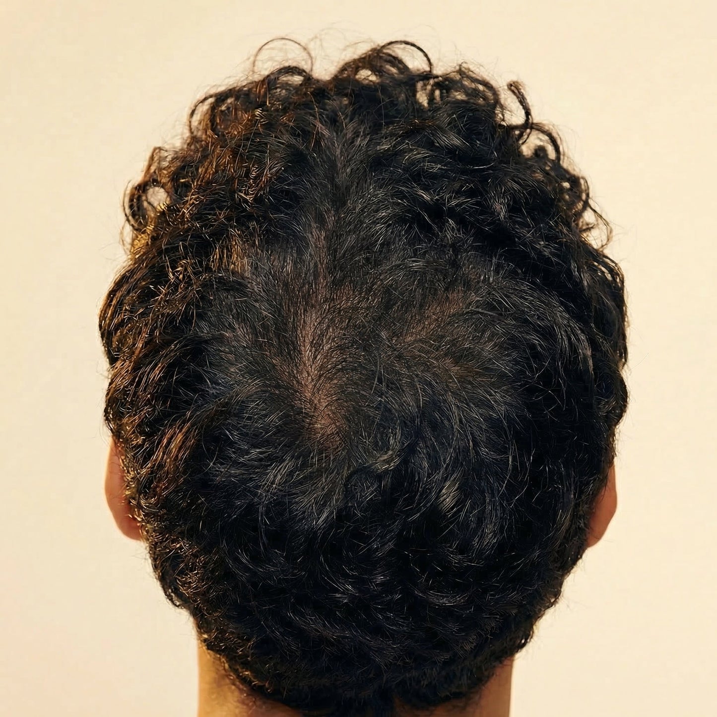 🎃Pumpkin Seed Regrowth Oil — Naturally Supports Thicker, Fuller Hair Growth✨💪